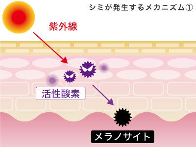 シミのメカニズム
