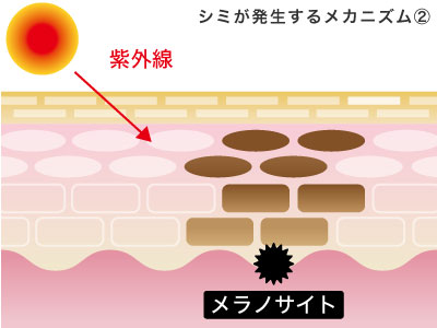 シミのメカニズム