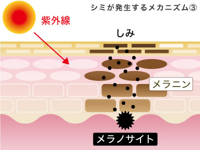 シミのメカニズム