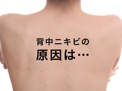 背中ニキビ原因