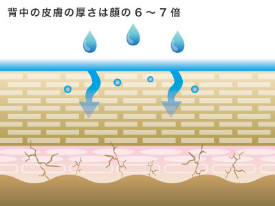 背中ニキビ改善