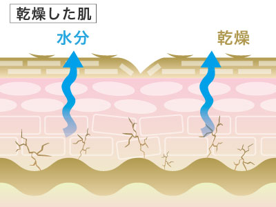 乾燥した肌
