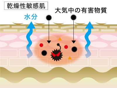 乾燥性敏感肌